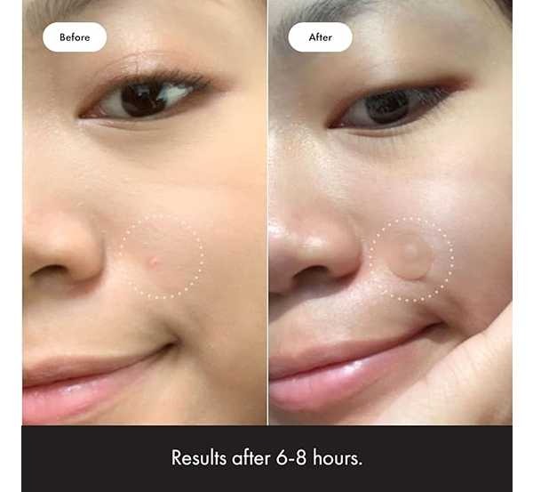 slider-img